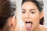 Vitamin B12 Deficiency