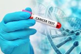Cancer Screening