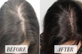 Hair care TIPS