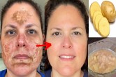 Reduce Pigmentation