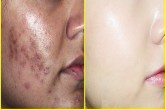 Oil Benefits soybean oil for Glowing skin