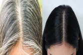 White Hair Home Remedies