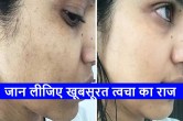 Skin Care TIPS