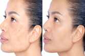 Glowing skin TIPS