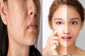 Skin Care TIPS Almond Oil For Glowing skin