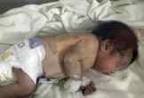 Delhi News, Newborn, LNJP, Delhi Crime News, Mustafabad