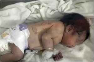 Turkiy syria Earthquake 2023 