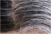 White Hair Problem
