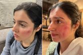 Divya Khosla Kumar Injured
