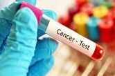 Galleri Blood Test