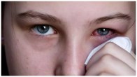 Eye Flu Precautions