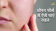 skin care tips, Home Remedies for Open Pores, beaty tips