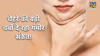 facial lipoatrophy,facial lipoatrophy treatment,facial lipoatrophy causes,facial lipoatrophy symptoms,lipodystrophy,facial lipoatrophy hiv,what causes fat atrophy, face fat reduction treatment,buccal fat removal surgery
