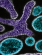 diseases