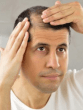 Hair Fall Reasons