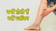 permanent nerve block for back pain,nerve block in leg,how long do nerve block injections last,what,can i expect after a nerve block injection,nerve block procedure for back pain,nerve block for surgery,nerve block pros and cons,nerve block procedure,permanent nerve block for back pain,what are the 4 types of nerve blocks,nerve block in leg,nerve block long-term side effects,nerve block anesthesia example,nerve block in neck symptoms,signs a nerve block is wearing off,what can i expect after a nerve block injection