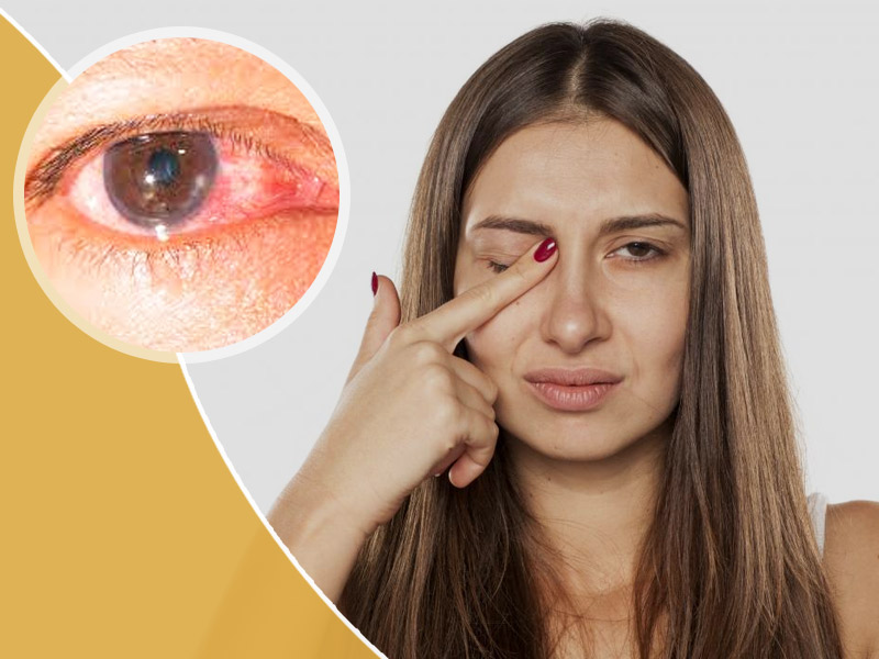 EYES PROBLEM