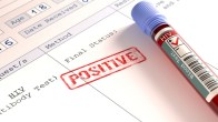 AIDS, HIV Positive, Kanpur News, Health News, UP News