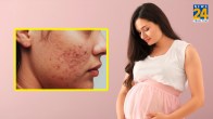 Prevent pimples