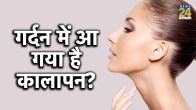 गर्दन में आ गया है कालापन