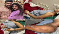 Boyfriend run over suv on lover in Mumbai
