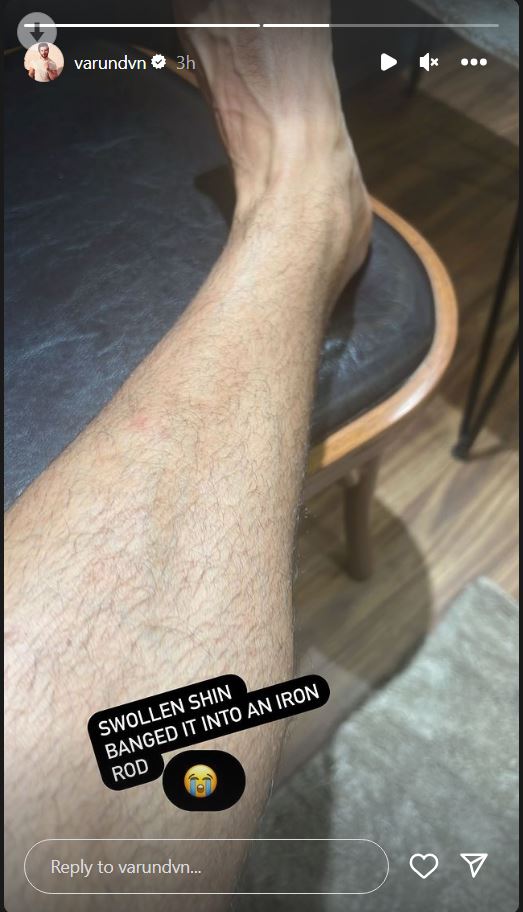 Varun Dhawan Injured