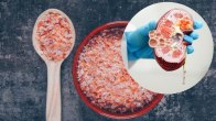 best salt for kidney patients