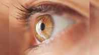 Eye
