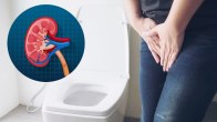 Frequent Urination