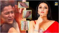 Mannara Chopra Scars