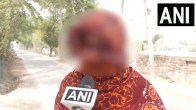 Sandeshkhali Violence victim