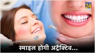 Smile Designing