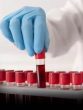 Blood Test