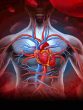 heart blockage