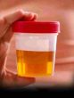 urine