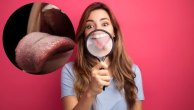 tongue reveal health problems