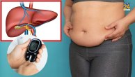 belly fat