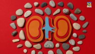 kidney stone problems