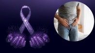 testicular cancer