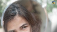 white hair causes