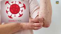 New Variants