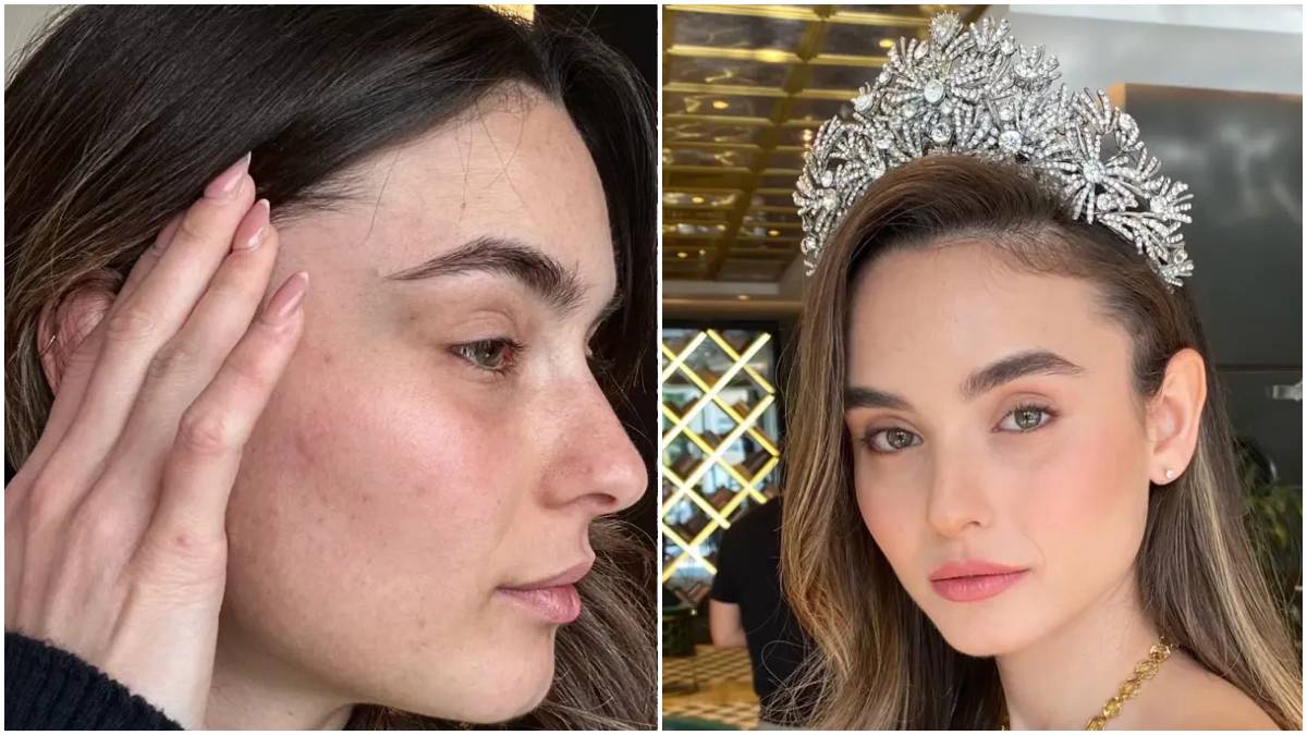 Noa Cochva Assaulted By Hamas Supporter