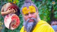 Premanand Maharaj Vrindavan Disease