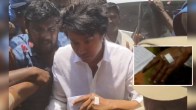 Thalapathy Vijay Injury Photos