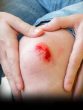 bleeding