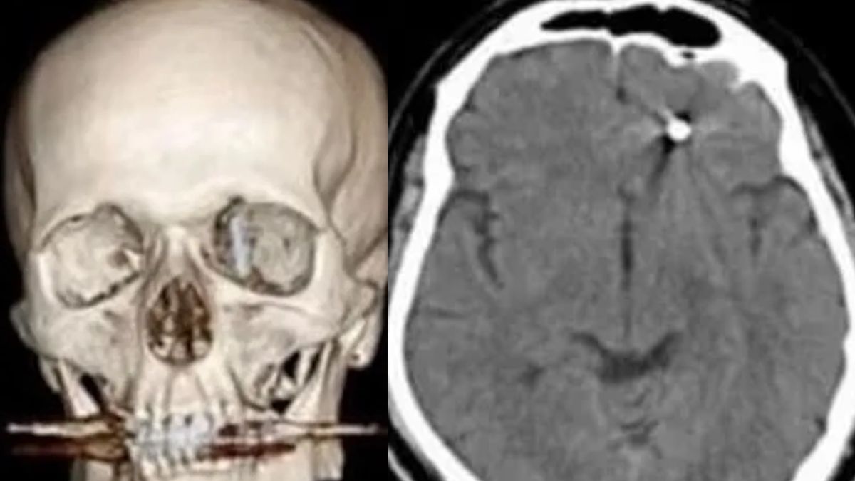 Mind Surgery