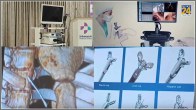 Medical Miracle Tamil Nadu Doctors Bronchoscopy To Remove Needle From Girl Lung