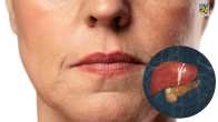 Liver Damage warning signs