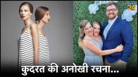 Conjoined Twin Sisters Shared One Vagina Private Part Homosexual Lesbian