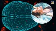 brain eating amoeba symptoms